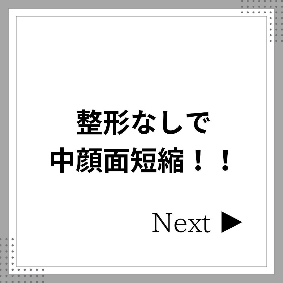 整形いらずで中顔面短縮🌿