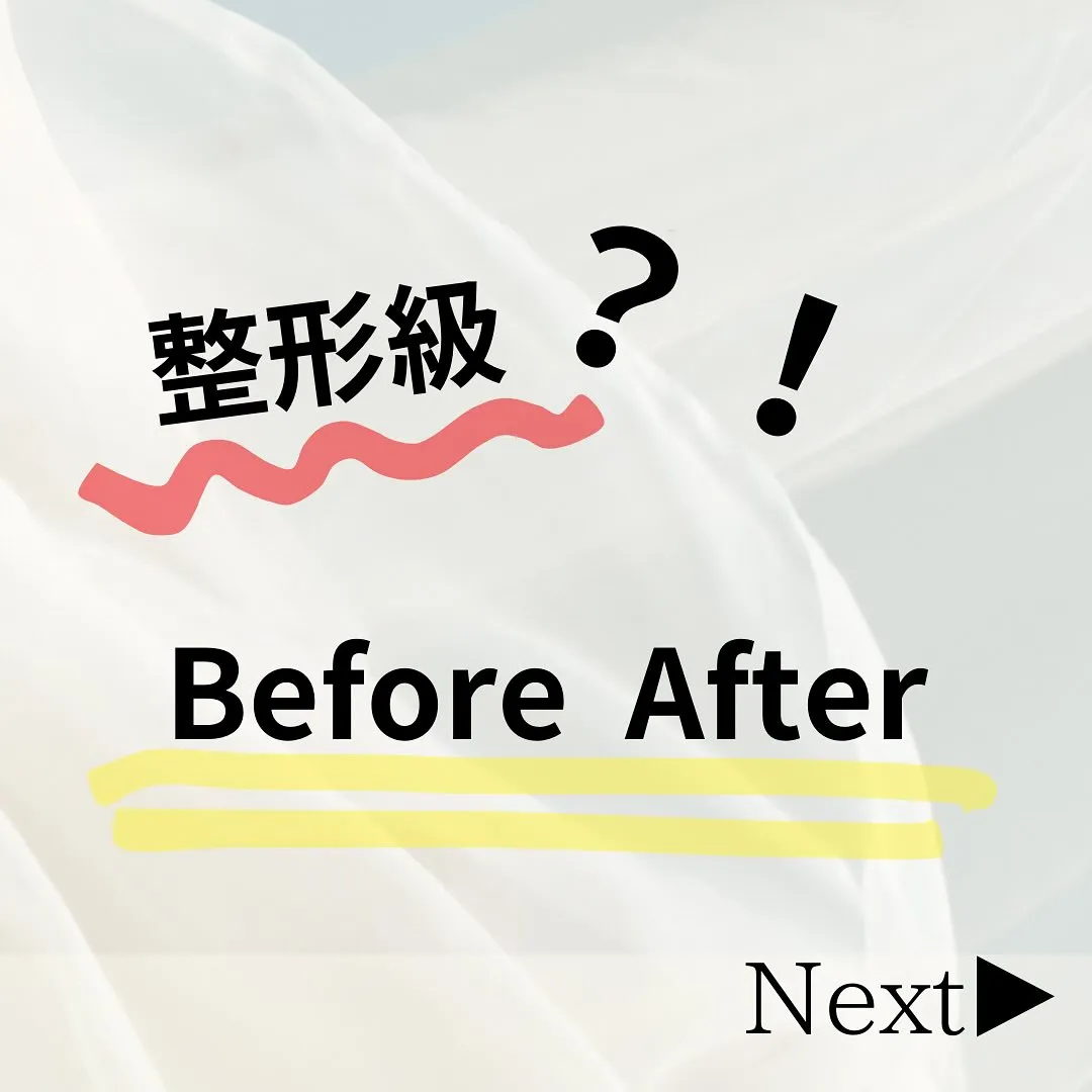 整形級？！まつ毛パーマBefore After🌿